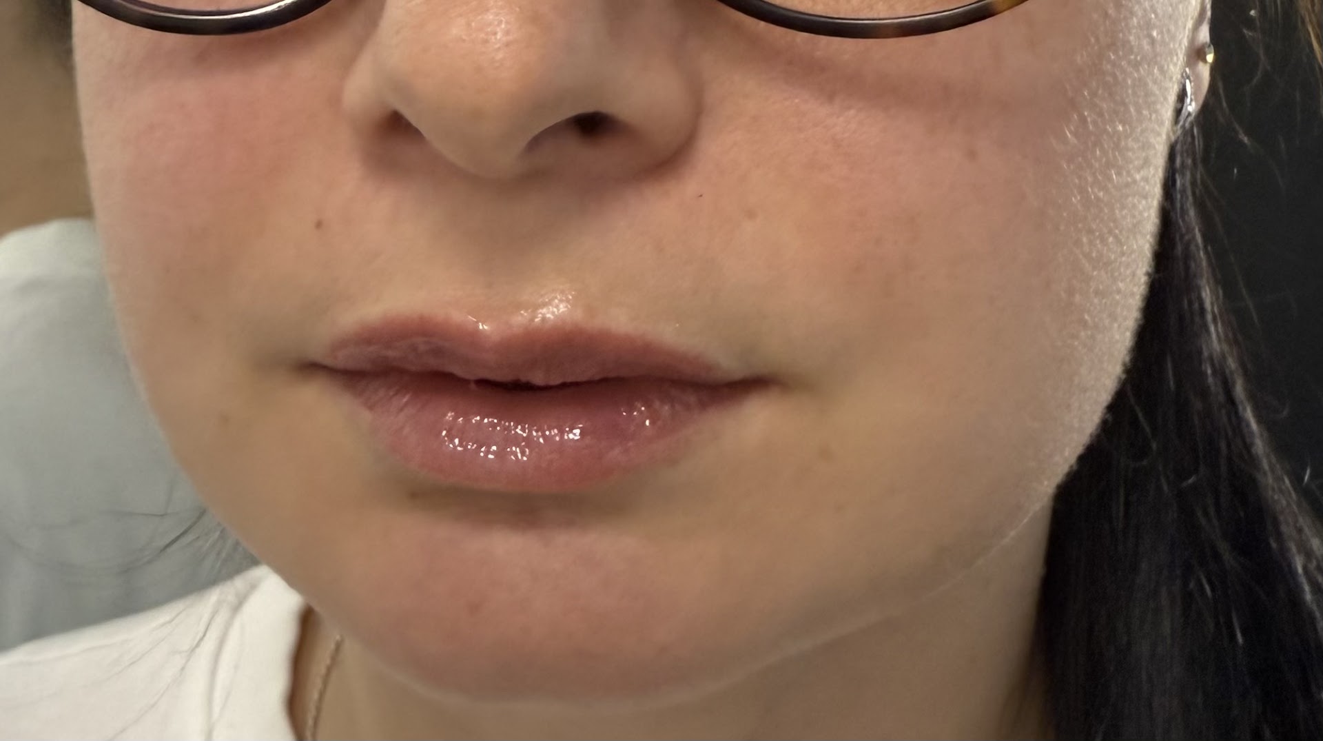 Skin Rejuvenation London · Photos 1